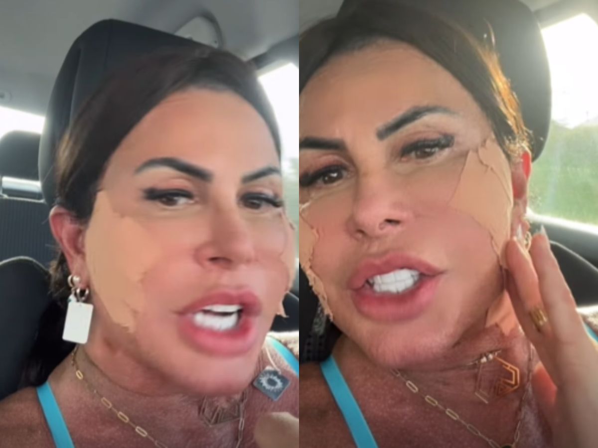 Gretchen ironiza haters após cirurgia plástica: “Bem amada e focada”